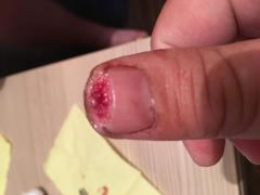 post-515-0-45468500-1525581983_thumb.jpeg